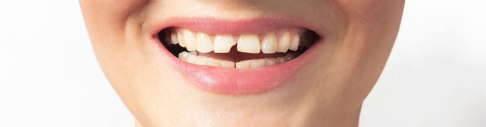 Bez názvu (1000 x 500 px) (2)